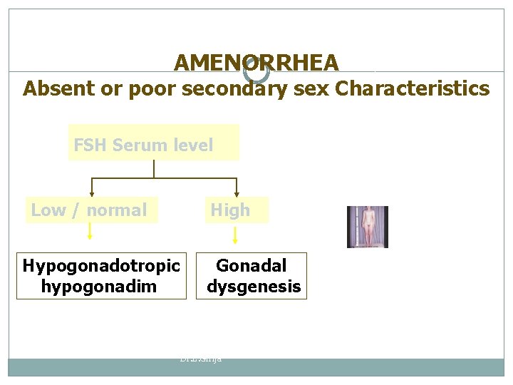 AMENORRHEA Absent or poor secondary sex Characteristics FSH Serum level Low / normal Hypogonadotropic