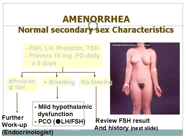 AMENORRHEA Normal secondary sex Characteristics - FSH, LH, Prolactin, TSH - Provera 10 mg