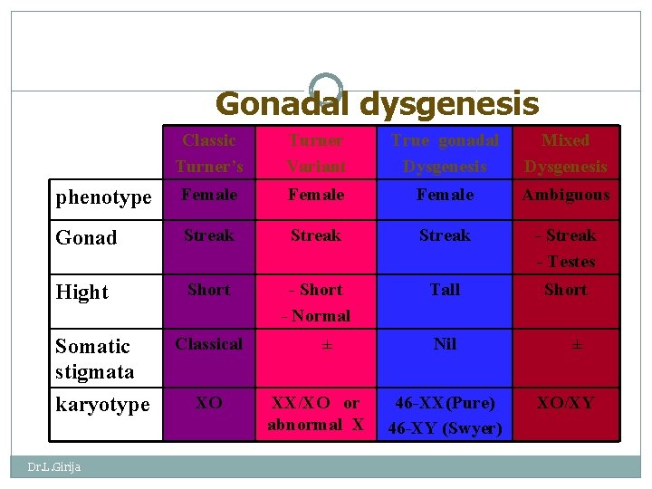 Gonadal dysgenesis Classic Turner’s Turner Variant True gonadal Dysgenesis Mixed Dysgenesis phenotype Female Ambiguous