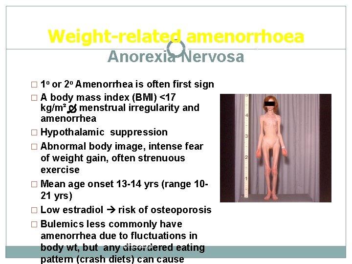 Weight-related amenorrhoea Anorexia Nervosa � 1 o or 2 o Amenorrhea is often first
