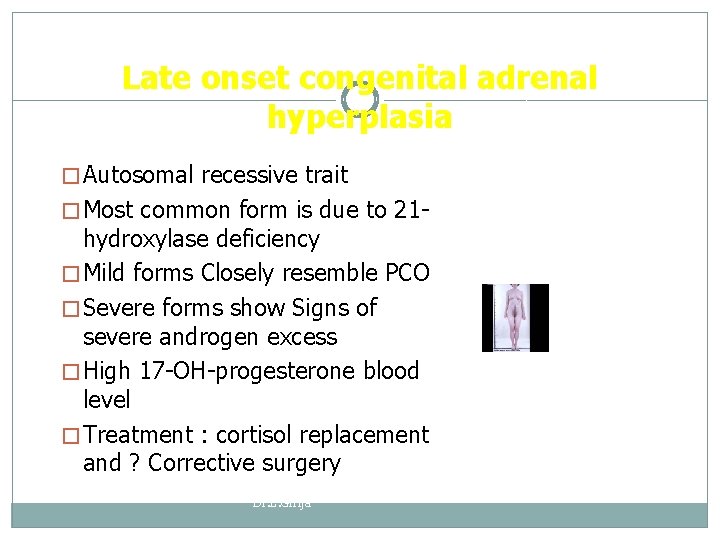 Late onset congenital adrenal hyperplasia � Autosomal recessive trait � Most common form is