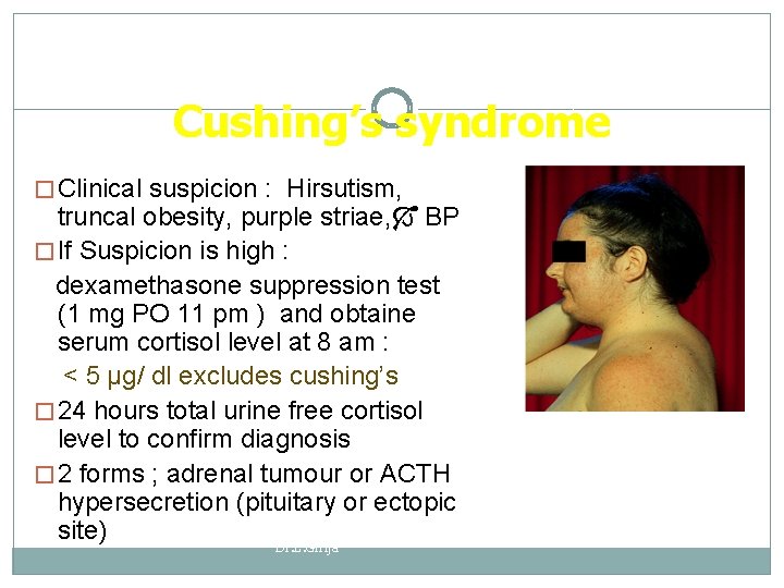 Cushing’s syndrome � Clinical suspicion : Hirsutism, truncal obesity, purple striae, BP � If