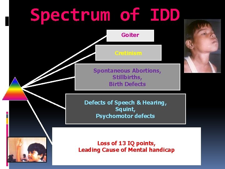 Spectrum of IDD Goiter Cretinism Spontaneous Abortions, Stillbirths, Birth Defects of Speech & Hearing,