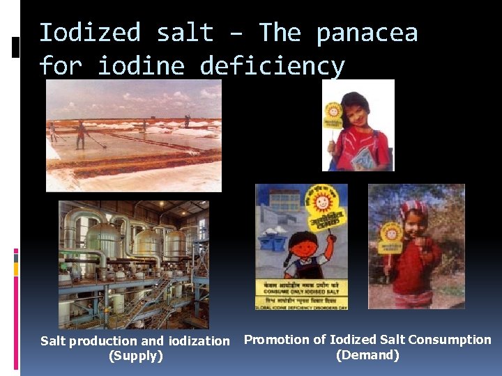 Iodized salt – The panacea for iodine deficiency Salt production and iodization (Supply) Promotion