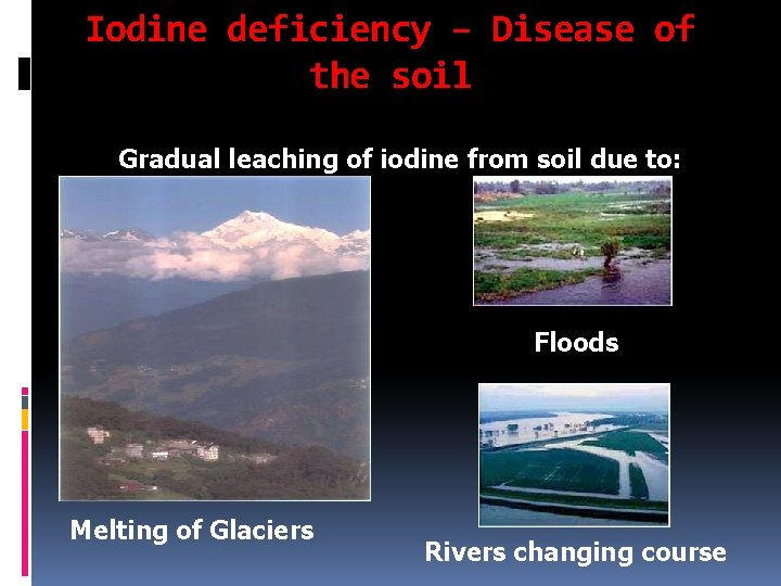 Iodine deficiency – Disease of the soil Gradual leaching of iodine from soil due