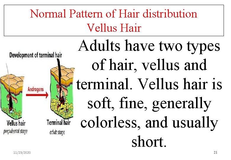 Normal Pattern of Hair distribution Vellus Hair Adults have two types of hair, vellus