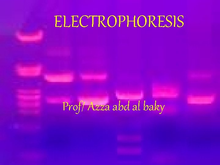 ELECTROPHORESIS Prof/ Azza abd al baky 