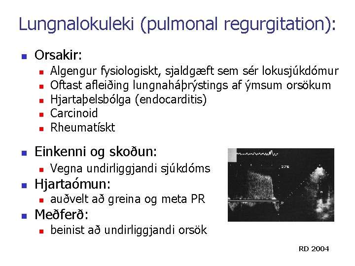 Lungnalokuleki (pulmonal regurgitation): n Orsakir: n n n Einkenni og skoðun: n n Vegna Lungnalokuleki (pulmonal regurgitation): n Orsakir: n n n Einkenni og skoðun: n n Vegna