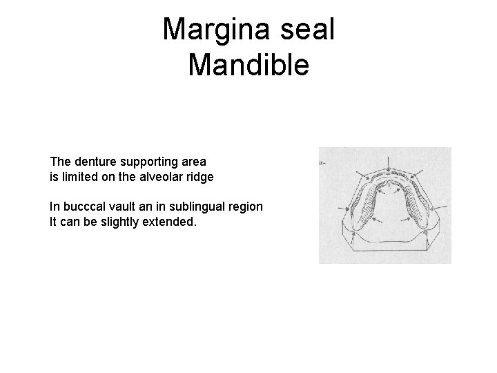 Margina seal Mandible The denture supporting area is limited on the alveolar ridge In