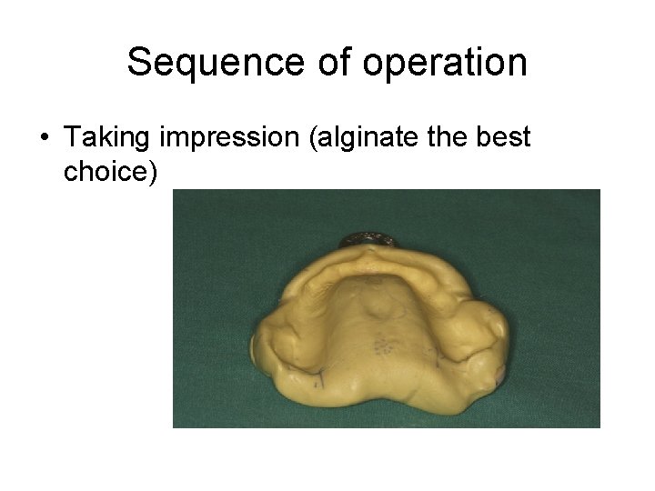 Sequence of operation • Taking impression (alginate the best choice) 