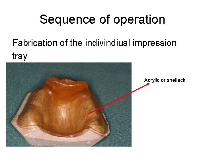 Sequence of operation Fabrication of the indivindiual impression tray Acrylic or shellack 