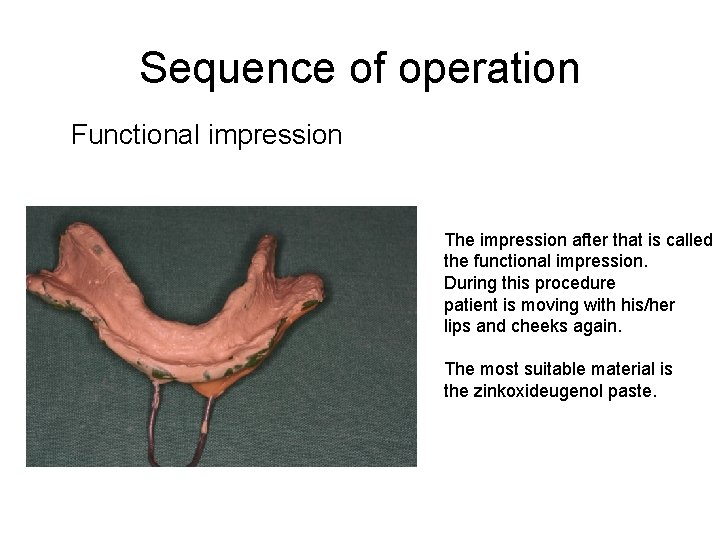 Sequence of operation Functional impression The impression after that is called the functional impression.