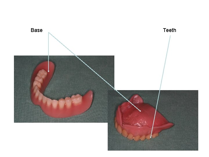 Base Teeth 