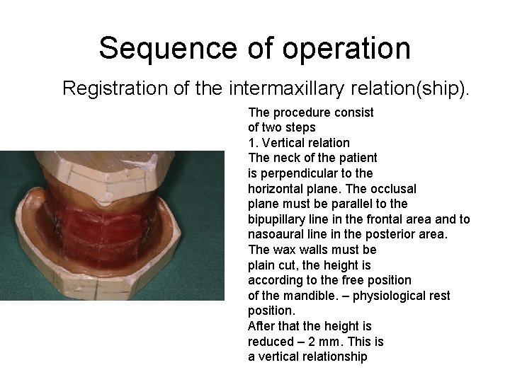 Sequence of operation Registration of the intermaxillary relation(ship). The procedure consist of two steps