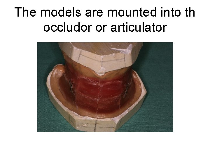 The models are mounted into th occludor or articulator 