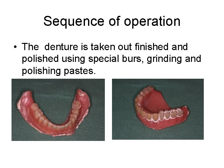 Sequence of operation • The denture is taken out finished and polished using special