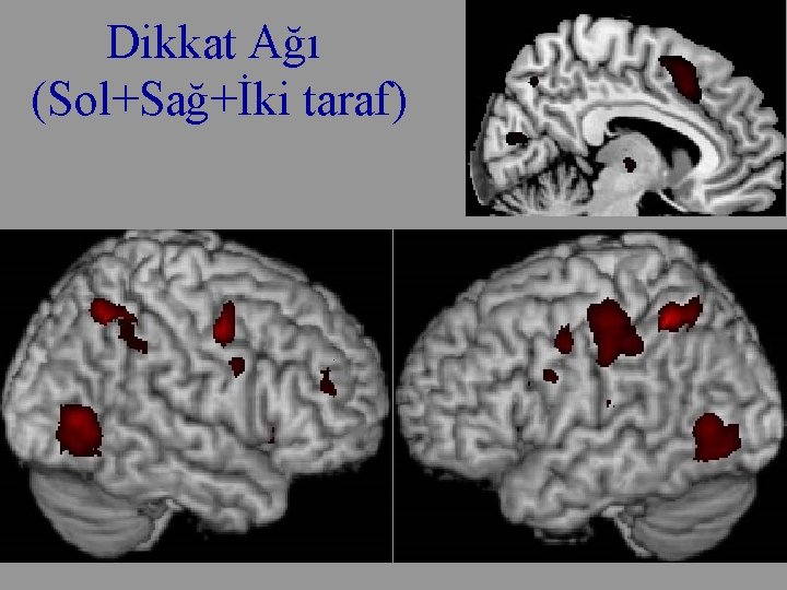 Dikkat Ağı (Sol+Sağ+İki taraf) 