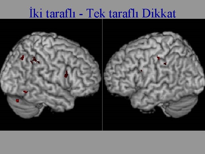 İki taraflı - Tek taraflı Dikkat 