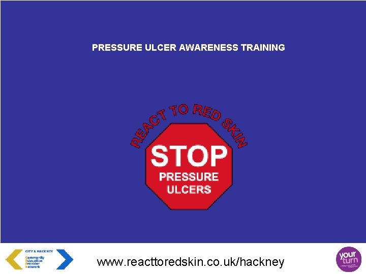 PRESSURE ULCER AWARENESS TRAINING www. reacttoredskin. co. uk/hackney 