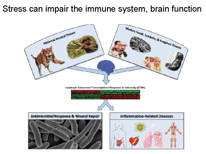 Stress can impair the immune system, brain function 