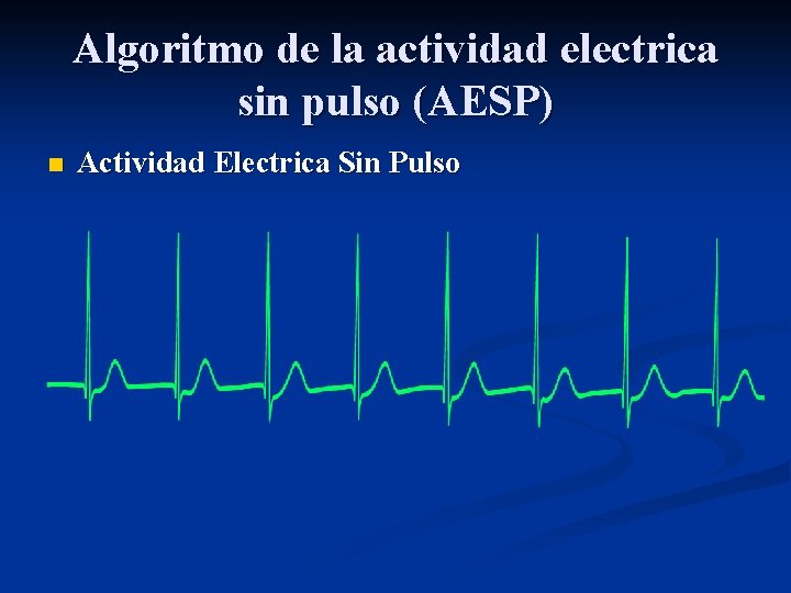 Algoritmo de la actividad electrica sin pulso (AESP) n Actividad Electrica Sin Pulso 