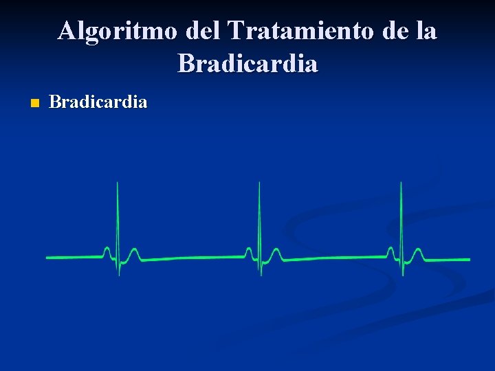 Algoritmo del Tratamiento de la Bradicardia n Bradicardia 