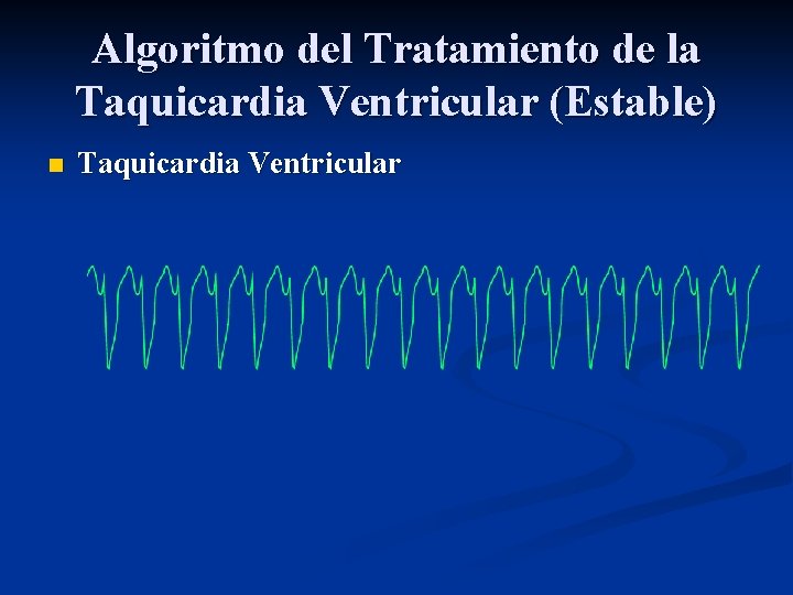 Algoritmo del Tratamiento de la Taquicardia Ventricular (Estable) n Taquicardia Ventricular 