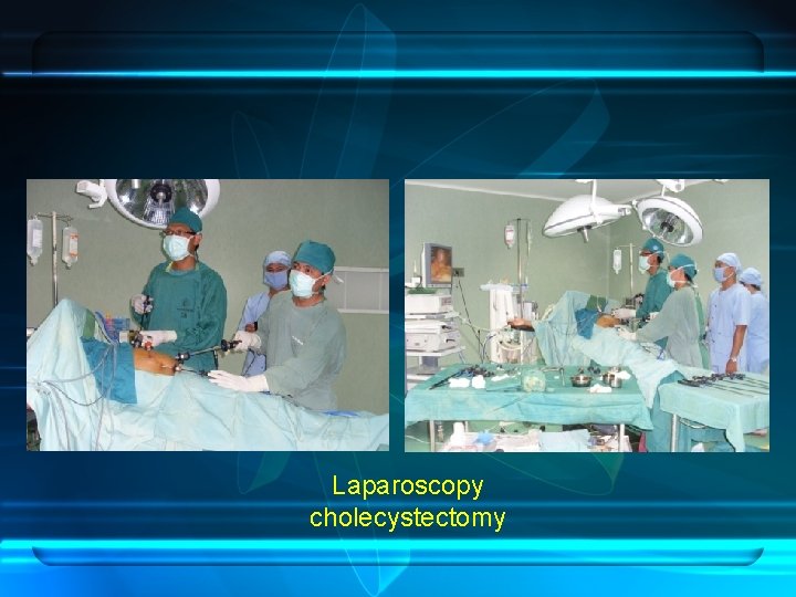 Laparoscopy cholecystectomy 