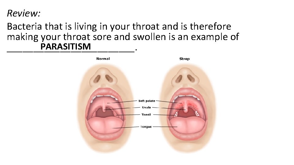 Review: Bacteria that is living in your throat and is therefore making your throat