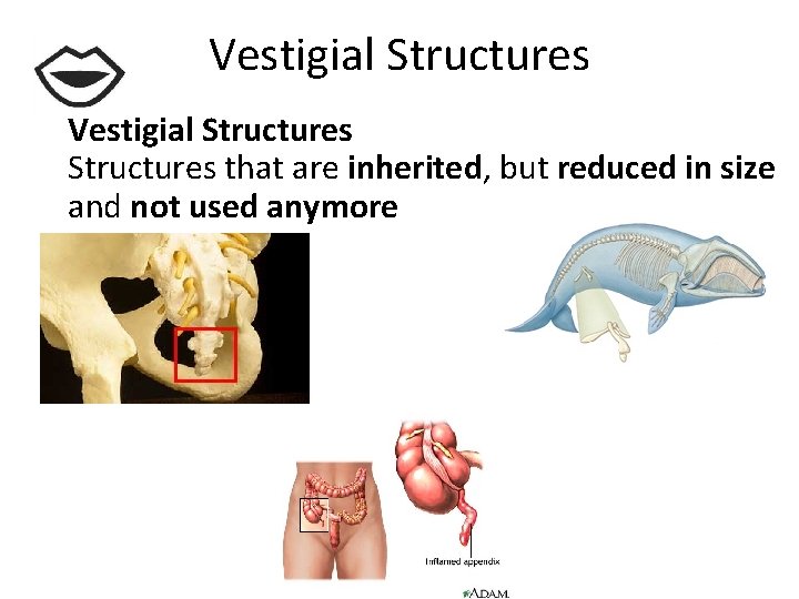 Vestigial Structures that are inherited, but reduced in size and not used anymore Whale