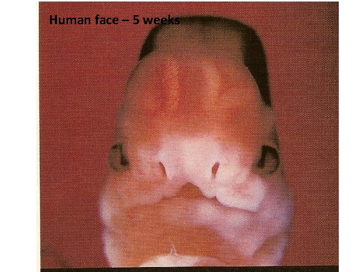 Human face – 5 weeks 