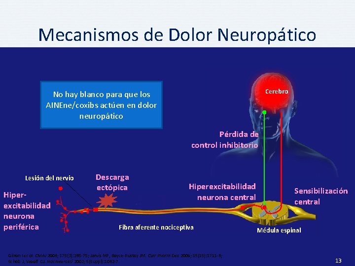 Mecanismos de Dolor Neuropático Cerebro No hay blanco para que los AINEne/coxibs actúen en