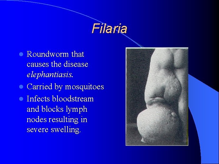 Filaria Roundworm that causes the disease elephantiasis. l Carried by mosquitoes l Infects bloodstream Filaria Roundworm that causes the disease elephantiasis. l Carried by mosquitoes l Infects bloodstream