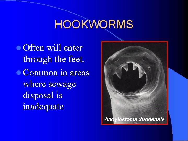 HOOKWORMS l Often will enter through the feet. l Common in areas where sewage HOOKWORMS l Often will enter through the feet. l Common in areas where sewage