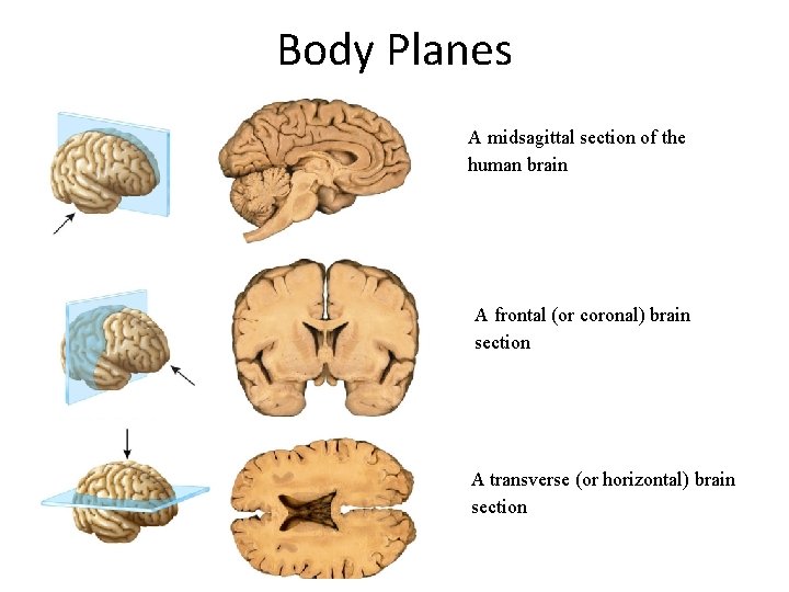 Body Planes A midsagittal section of the human brain A frontal (or coronal) brain