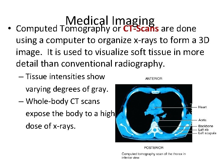  • Medical Imaging Computed Tomography or CT-Scans are done using a computer to