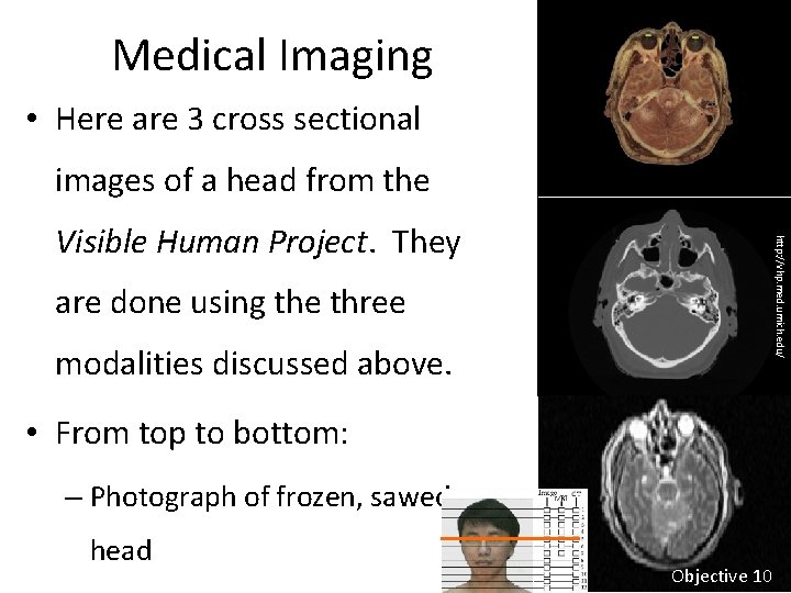 Medical Imaging • Here are 3 cross sectional images of a head from the