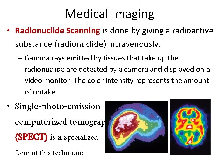 Medical Imaging • Radionuclide Scanning is done by giving a radioactive substance (radionuclide) intravenously.