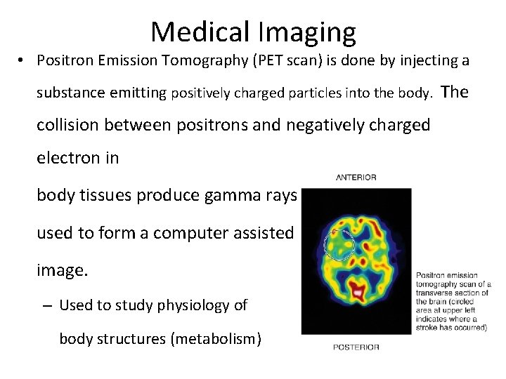 Medical Imaging • Positron Emission Tomography (PET scan) is done by injecting a substance