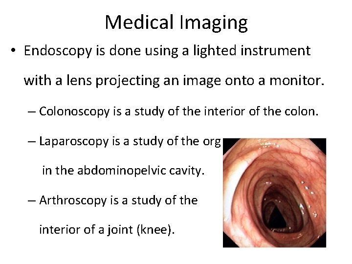 Medical Imaging • Endoscopy is done using a lighted instrument with a lens projecting