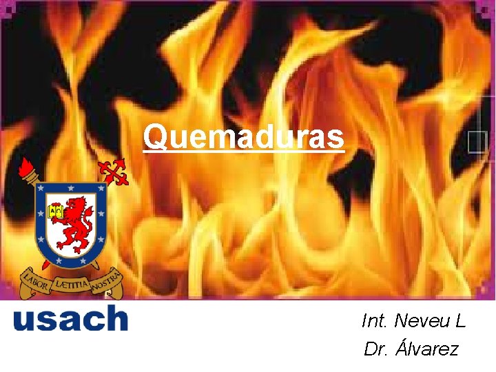 Quemaduras Int. Neveu L Dr. Álvarez 