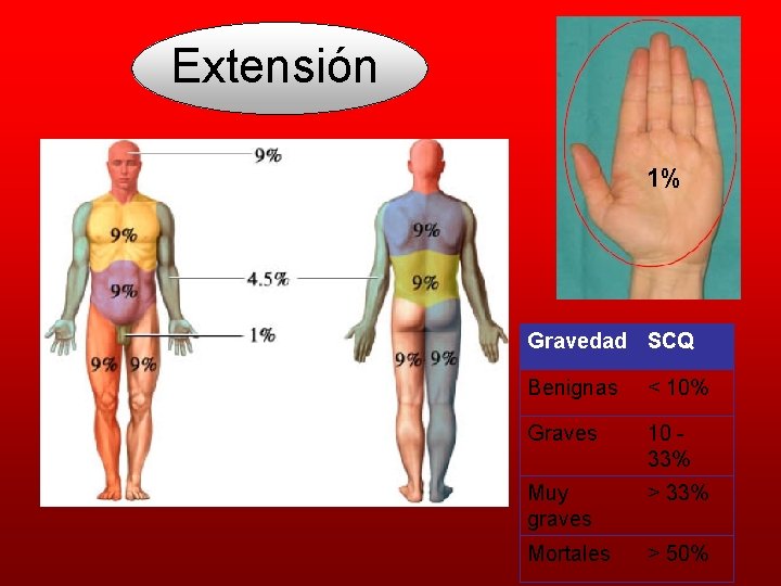 Extensión 1% Gravedad SCQ Benignas < 10% Graves 10 33% Muy graves > 33%