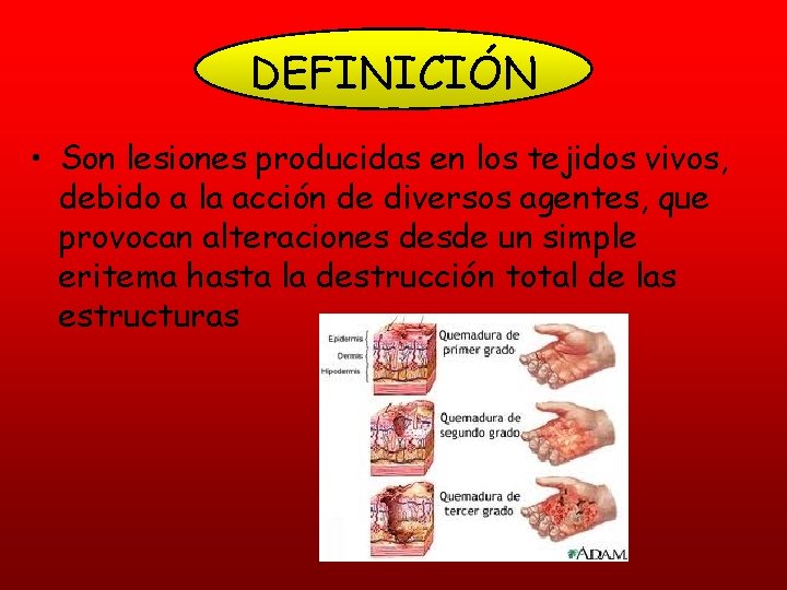 DEFINICIÓN • Son lesiones producidas en los tejidos vivos, debido a la acción de