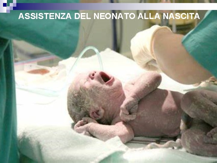 ASSISTENZA DEL NEONATO ALLA NASCITA 