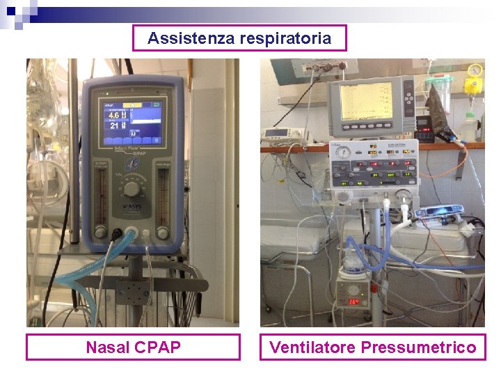 Assistenza respiratoria Nasal CPAP Ventilatore Pressumetrico 