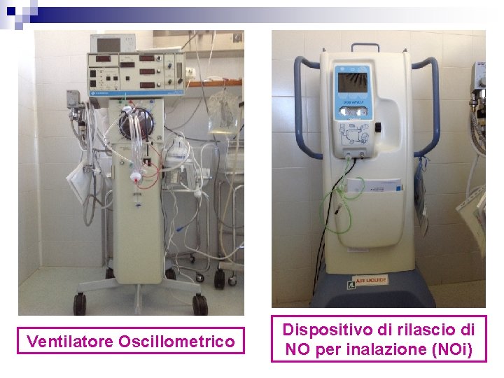 Ventilatore Oscillometrico Dispositivo di rilascio di NO per inalazione (NOi) 