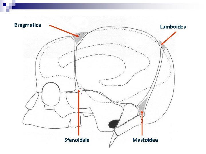 Bregmatica Lamboidea Sfenoidale Mastoidea 