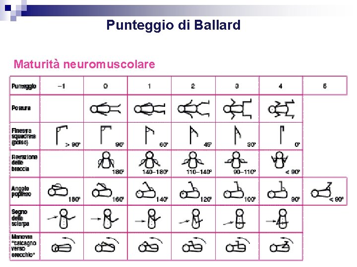 Punteggio di Ballard Maturità neuromuscolare 