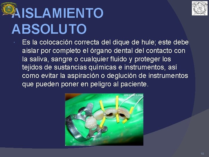 AISLAMIENTO ABSOLUTO Es la colocación correcta del dique de hule; este debe aislar por