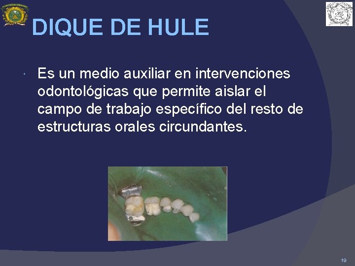 DIQUE DE HULE Es un medio auxiliar en intervenciones odontológicas que permite aislar el